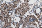 POTEA Antibody in Immunohistochemistry (Paraffin) (IHC (P))