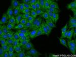 MTMR4 Antibody in Immunocytochemistry (ICC/IF)