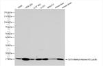 Di/Tri-Methyl-Histone H3 (Lys36) Antibody in Western Blot (WB)