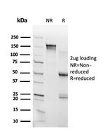 THG1/RHOXF2 Antibody in SDS-PAGE (SDS-PAGE)