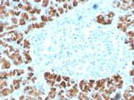 Insulinoma Associated 2/INSM2 Monoclonal Antibody (INSM2, 4291)