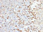 TIM3/HAVCR2/CD366 (Effector T-Cell Marker) Antibody in Immunohistochemistry (Paraffin) (IHC (P))