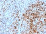 TIM3/HAVCR2/CD366 (Effector T-Cell Marker) Antibody in Immunohistochemistry (Paraffin) (IHC (P))