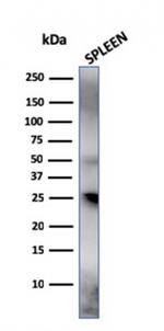 TIM3/HAVCR2/CD366 (Effector T-Cell Marker) Antibody in Western Blot (WB)