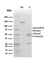 TIM3/HAVCR2/ CD366 (Effector T-Cell Marker) Antibody in SDS-PAGE (SDS-PAGE)