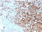 TIM3/HAVCR2/ CD366 (Effector T-Cell Marker) Antibody in Immunohistochemistry (Paraffin) (IHC (P))