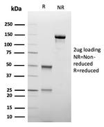 TIM3/HAVCR2/ CD366 (Effector T-Cell Marker) Antibody in SDS-PAGE (SDS-PAGE)