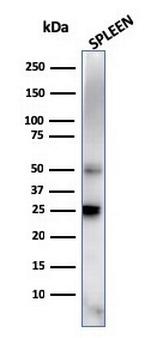 TIM3/HAVCR2/ CD366 (Effector T-Cell Marker) Antibody in Western Blot (WB)