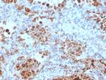 TIM3/HAVCR2/CD366 (Effector T-Cell Marker) Monoclonal Antibody (TIM3/4028)
