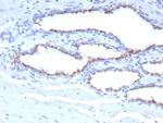 Prostein (p501S)/Solute Carrier Family 45 Member 3 (SLC45A3) Monoclonal Antibody (SLC45A3/7653)