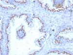 Prostein (p501S)/Solute Carrier Family 45 Member 3 (SLC45A3) Monoclonal Antibody (SLC45A3/7649)