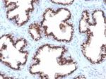 Prostein (p501S)/Solute Carrier Family 45 Member 3 (SLC45A3) Recombinant Rabbit Monoclonal Antibody (ZR9)
