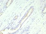 Prostein (p501S)/Solute Carrier Family 45 Member 3 (SLC45A3) Recombinant Rabbit Monoclonal Antibody (SLC45A3/9216R)