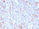 MRP3 (Multidrug Resistance-Associated Protein 3) Monoclonal Antibody (ABCC3, 2971)