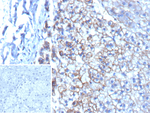 MRP3 (Multidrug Resistance-Associated Protein 3) Recombinant Mouse Monoclonal Antibody (rDTX1)