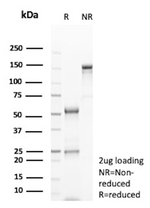 MRP3 (Multidrug Resistance-Associated Protein 3) Antibody in SDS-PAGE (SDS-PAGE)