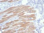 Sarcomeric Actinin Alpha 2/ACTN2 Recombinant Mouse Monoclonal Antibody (rACTN2/7361)