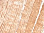 Sarcomeric Actinin Alpha 2/ACTN2 Monoclonal Antibody (ACTN2, 3293)