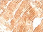 Sarcomeric Actinin Alpha 2/ACTN2 Antibody in Immunohistochemistry (Paraffin) (IHC (P))