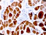 Sarcomeric Actinin Alpha 2/ACTN2 Monoclonal Antibody (ACTN2, 3294)