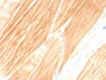 Sarcomeric Actinin Alpha 2/ACTN2 Monoclonal Antibody (ACTN2/3295)
