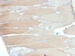 Sarcomeric Actinin Alpha 2/ACTN2 Recombinant Rabbit Monoclonal Antibody (ACTN2/7039R)