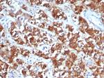 IL18R1 Monoclonal Antibody (IL18R1/7591)