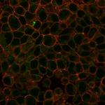 Histone Deacetylase 1 (HDAC3) Antibody in Immunocytochemistry (ICC/IF)