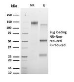Histone Deacetylase 1 (HDAC3) Antibody in SDS-PAGE (SDS-PAGE)