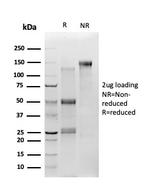 TSC22D1 Antibody in SDS-PAGE (SDS-PAGE)