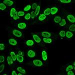Cyclin B1 (G2- and M-phase Cyclin) Monoclonal Antibody (SPM619)