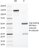 BCL10 (MALT-Lymphoma Marker) Antibody in SDS-PAGE (SDS-PAGE)