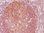 BCL10 (MALT-Lymphoma Marker) Monoclonal Antibody (BL10/411)