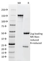BCL10 (MALT-Lymphoma Marker) Antibody in SDS-PAGE (SDS-PAGE)
