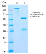 BCL10 Antibody in SDS-PAGE (SDS-PAGE)