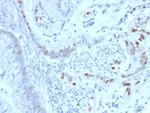 Cyclin E (G1/S-Phase Cyclin) Monoclonal Antibody (CCNE1/2460)