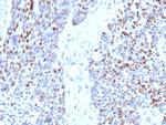 Cyclin E (G1/S-Phase Cyclin) Recombinant Mouse Monoclonal Antibody (rCCNE1, 4936)