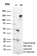 Cyclin E (G1/S-Phase Cyclin) Antibody in SDS-PAGE (SDS-PAGE)