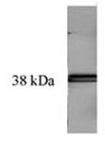 Bacterial Transglutaminase Antibody in Western Blot (WB)