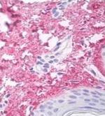 Collagen V Alpha-1 Chain (NC2 domain) Antibody in Immunohistochemistry (Paraffin) (IHC (P))