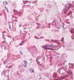 Collagen V Alpha-1 Chain (VR domain) Antibody in Immunohistochemistry (Paraffin) (IHC (P))