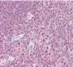Cytokine Receptor-Like Factor 2 Antibody in Immunohistochemistry (Paraffin) (IHC (P))