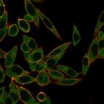 ZNF622/ZPR9 (Transcription Factor) Monoclonal Antibody (PCRP-ZNF622-1C11)