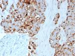 GPRC5A/PEIG-1/RAI3/RAIG1/TIG1 Monoclonal Antibody (GPRC5A/7893)