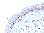 CD1a/HTA1 (Mature Langerhans Cells Marker) Antibody in Immunohistochemistry (Paraffin) (IHC (P))