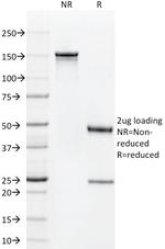 CD1a/HTA1 (Mature Langerhans Cells Marker) Antibody in SDS-PAGE (SDS-PAGE)