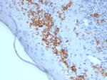 CD1a/HTA1 (Mature Langerhans Cells Marker) Monoclonal Antibody (rC1A/8110)