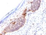 CD1a (Mature Langerhans Cells Marker) Antibody in Immunohistochemistry (Paraffin) (IHC (P))