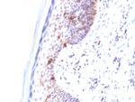 CD1a/HTA1 (Mature Langerhans Cells Marker) Antibody in Immunohistochemistry (Paraffin) (IHC (P))
