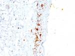 CD1a/HTA1 (Mature Langerhans Cells Marker) Antibody in Immunohistochemistry (Paraffin) (IHC (P))